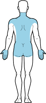 Electrolysis is commonly used to treat the backs, torsos, and hands of male clients. Commonly Treated Areas - Male