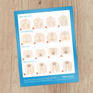 Hirsutism Chart  8.5x11 Consultation Card - Rated R
